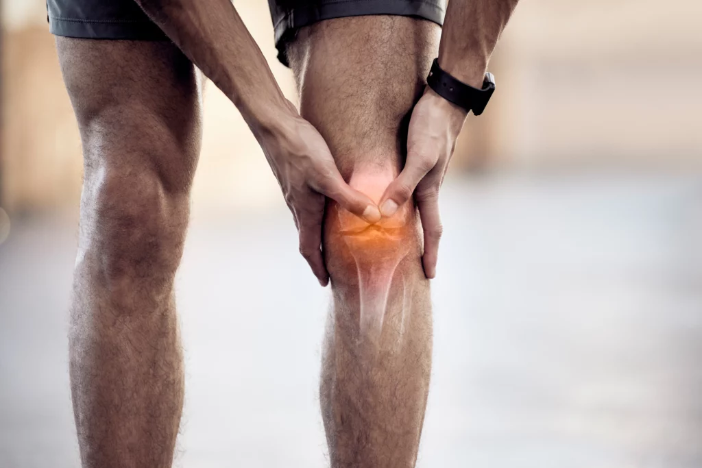 Luxación de rodilla: qué es y cómo se puede tratar